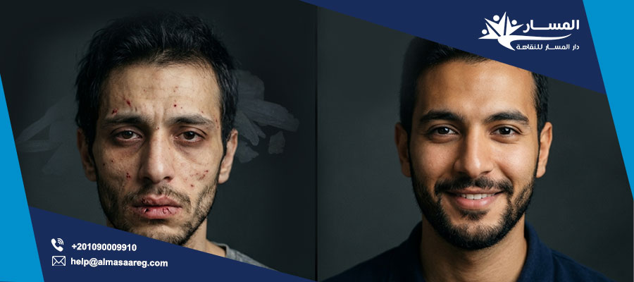 أضرار الآيس المخدر على الوجه